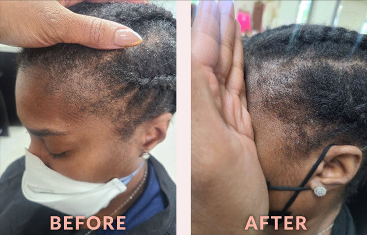 “I was very pleased with the product and wouldn’t change anything. It was very light and I saw results!”- E. Barnes